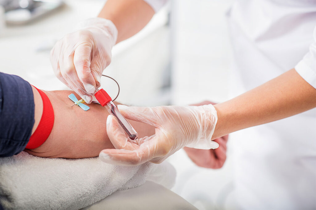 checkup exames